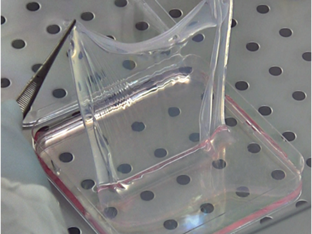 Lembo di epidermide geneticamente corretta Lembo di epidermide geneticamente corretta